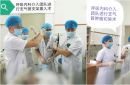 我院成功通過纖支鏡施行支氣管手術(shù)治愈兩位呼吸困難患者
