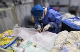 梧州市工人醫(yī)院采用血漿置換救回“毒鼠強”中毒患兒