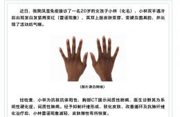 【讓罕見被看見·壹】患上這種病，人體各處器官會逐漸硬化